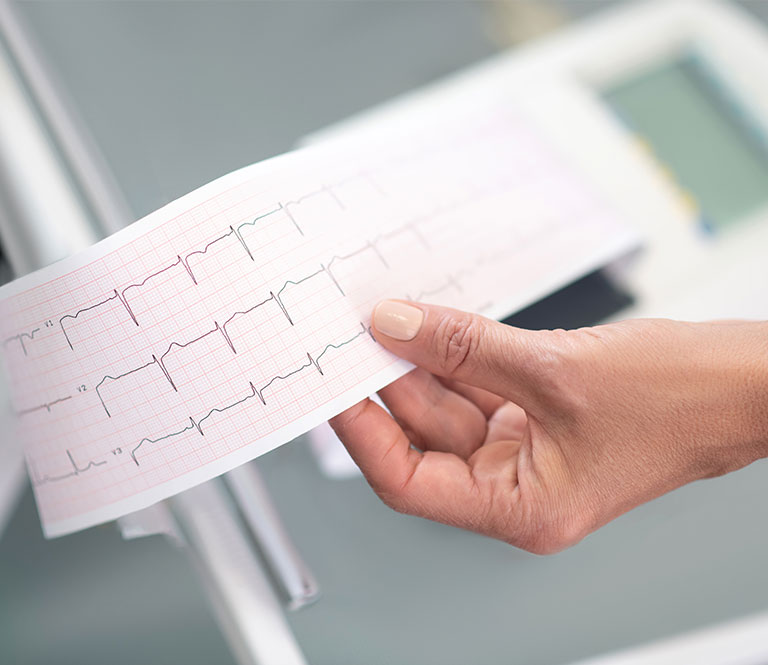 Electrocardiogramme 