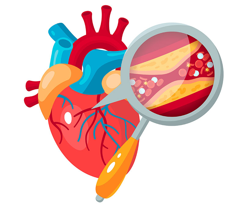  suivi cardiologique